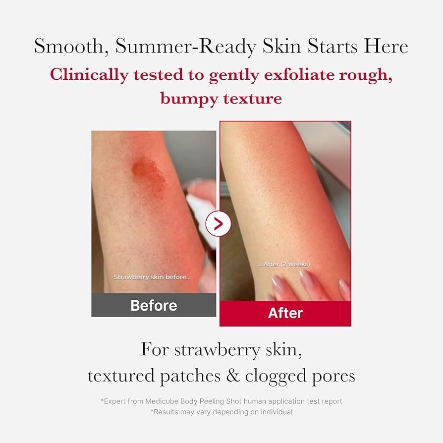 Medicube Red Acne Body Peeling Shot Spray Cleanser