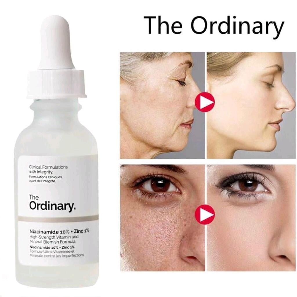 The Ordinary Niacinamide 10% Zinc 1% Serum - 30ml