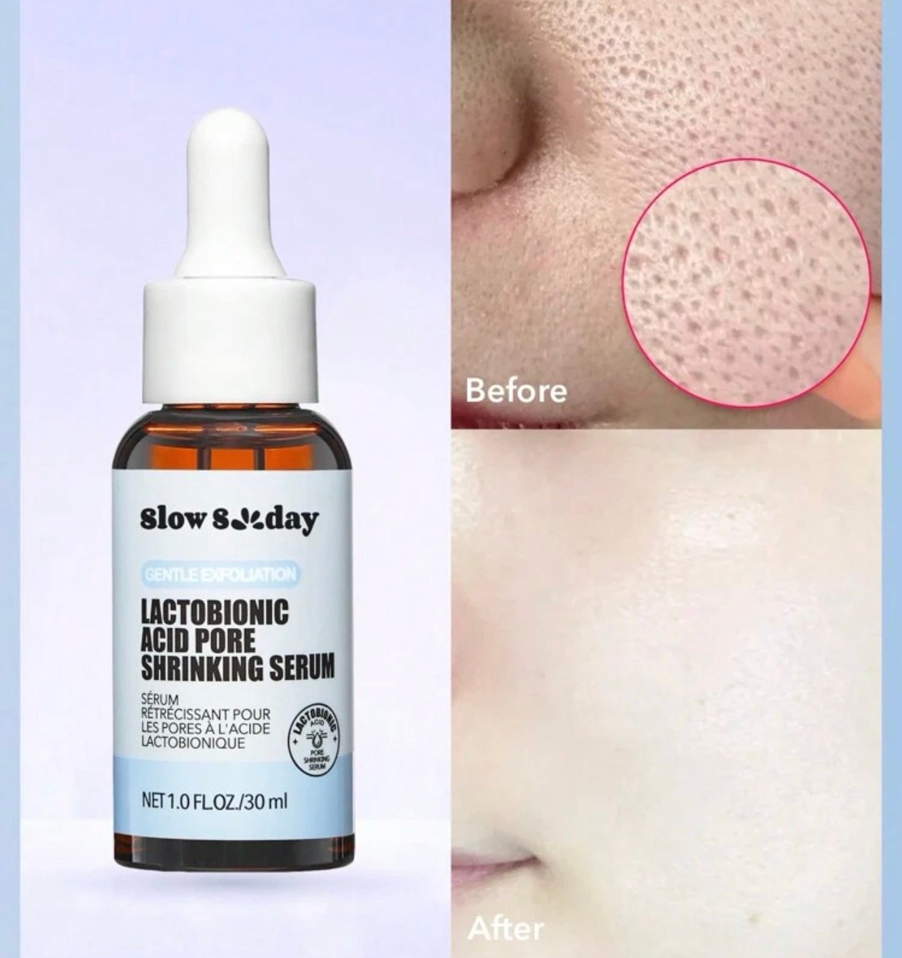 سيروم حمض اللاكتوبيونيك لتقليص المسام وتنعيم البشرة Lactobionic Acid Pore Shrinking Serum