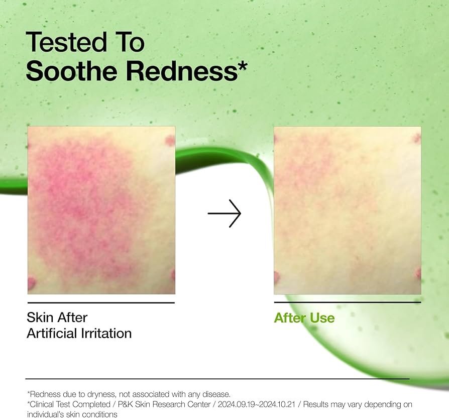 ANUA Azelaic Acid 10 Hyaluron Redness Soothing Serum 30ML - Image 8