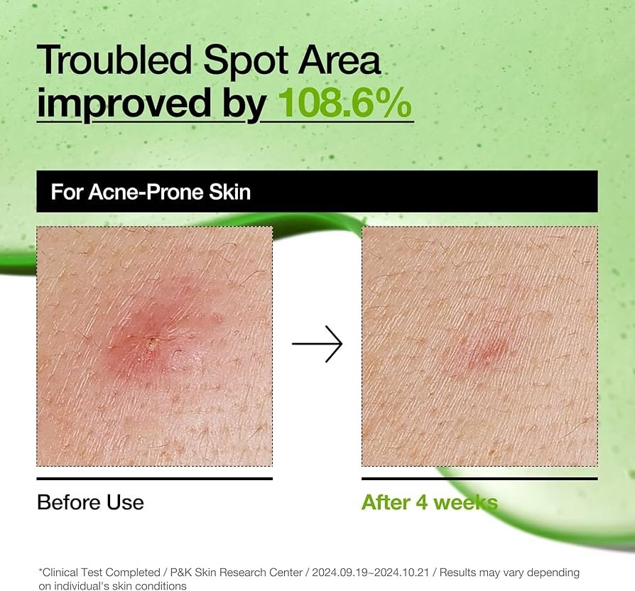 ANUA Azelaic Acid 10 Hyaluron Redness Soothing Serum 30ML - Image 5